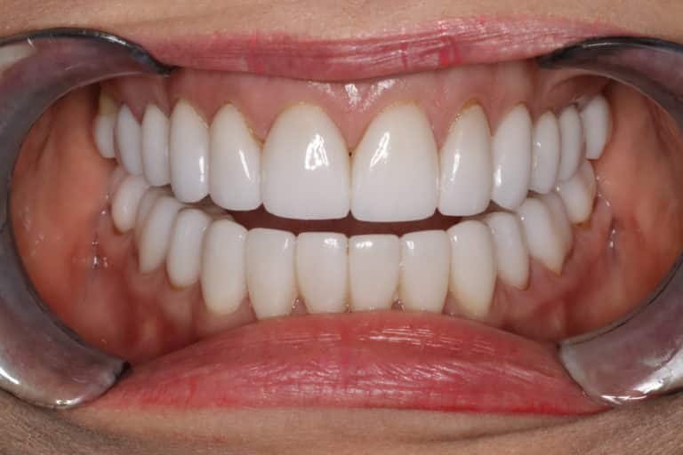 Konig Center for Cosmetic & Comprehensive Dentistry smile photos